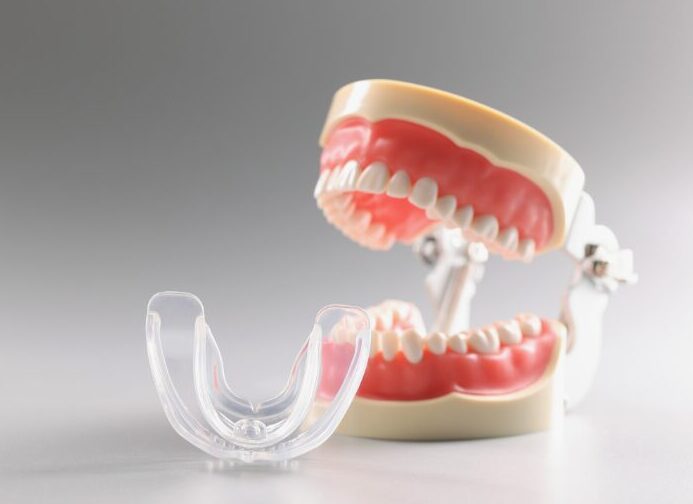 小児矯正・咬合育成のイメージ