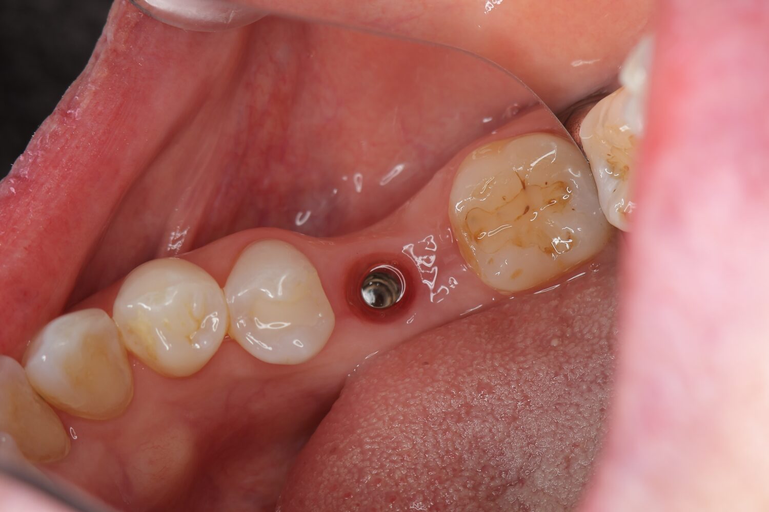 治癒期間の様子